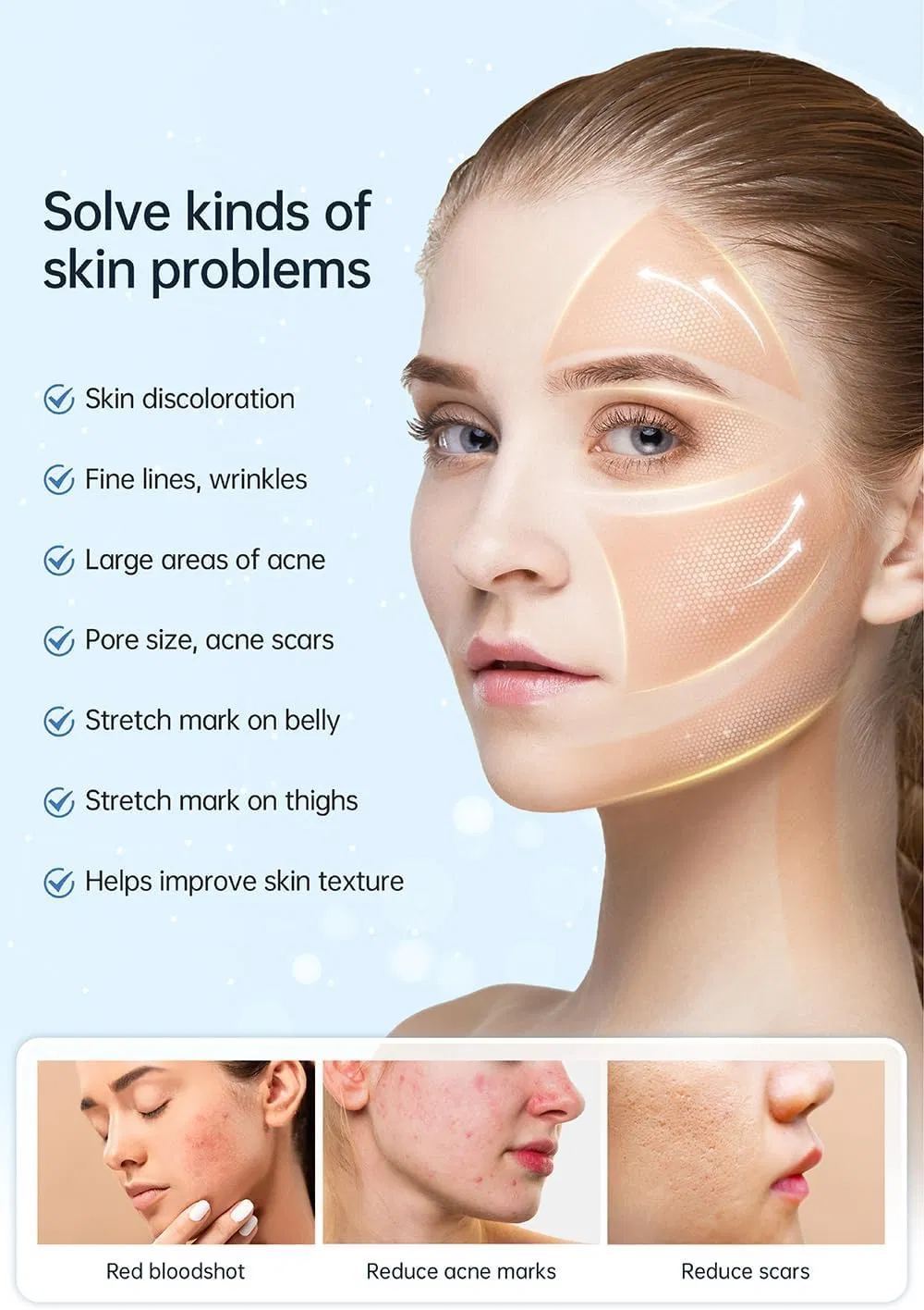 Hydra Pen H5 ใหม่ สารบรรทุกการฉีดน้ํายาเซรั่ม EMS และ Microneedling การใช้งานอัตโนมัติ 4