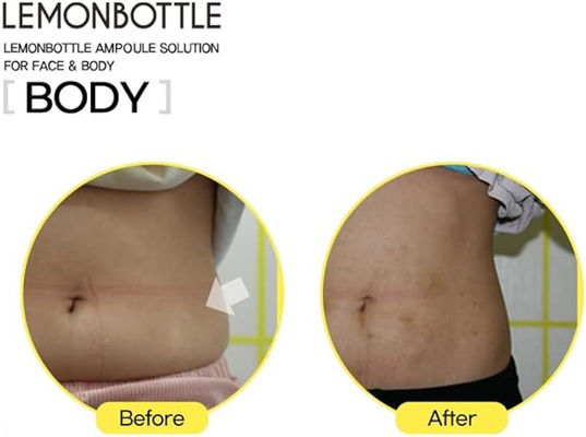 กระป๋องมะนาว 10 มิลลิลิตร*5 แก้ไขมันเกินและลดน้ําหนัก Lipolab Kabelline