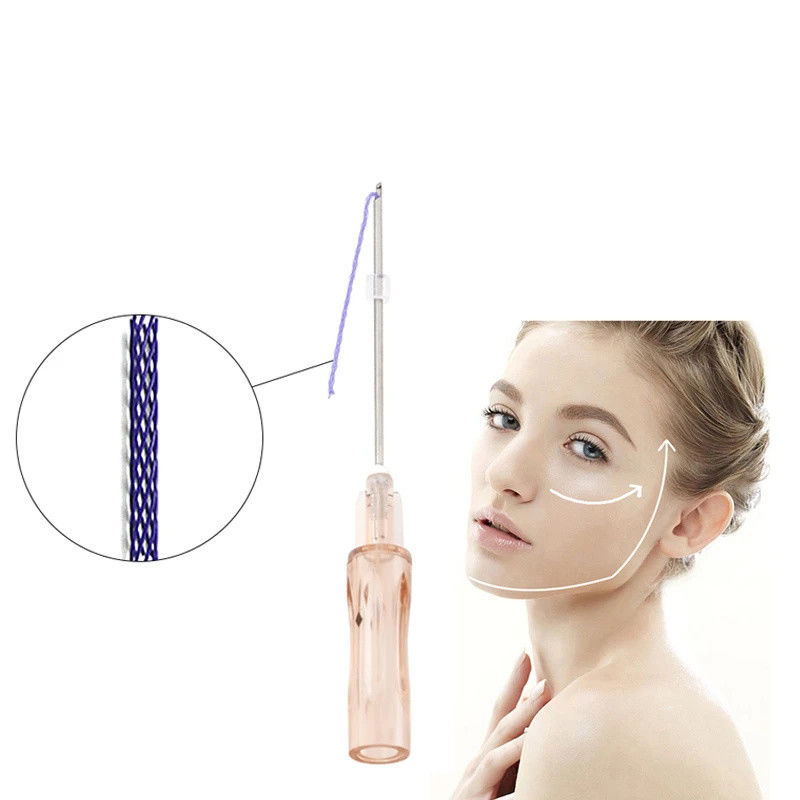 เกาหลี สแตนเลส V Line Absorbable Face Twist Mono Barbed Pdo Nose Lift Thread Tornado Cog 3D 4D 6D Pdo Thread สายด้าย